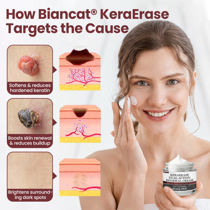 KeraErase® Dual-Action Renewal Cream( Buy 1 Get 1 Free)