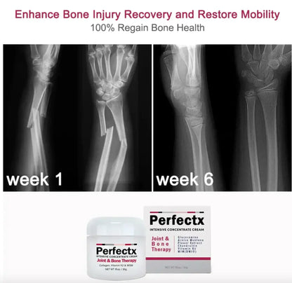 Perfectx Joint and Bone Treatment Cream (Buy 1 Get 2 Free)